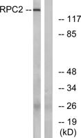 POLR3B Polyclonal Antibody
