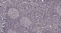 POLR3C Polyclonal Antibody