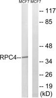 POLR3D Polyclonal Antibody