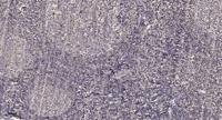 POLR3D Polyclonal Antibody