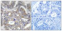 POLR3E Polyclonal Antibody