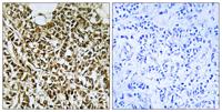 POLR3E Polyclonal Antibody