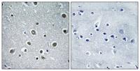 POLR3H Polyclonal Antibody