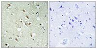POM121 Polyclonal Antibody