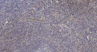 POT1 Polyclonal Antibody
