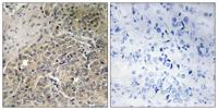 POTE14/22 Polyclonal Antibody