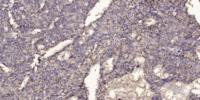 POTE-14/22 Polyclonal Antibody