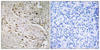 POTE-8 Polyclonal Antibody