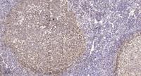 AMPKβ1 Polyclonal Antibody