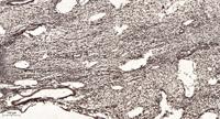 AMY-1 Polyclonal Antibody