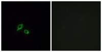 GIPR Polyclonal Antibody