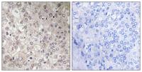 GIPR Polyclonal Antibody