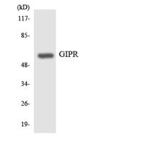 GIPR Polyclonal Antibody