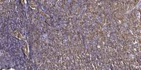 GIT1 Polyclonal Antibody