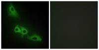 GK1 Polyclonal Antibody