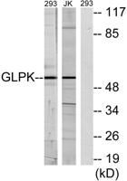 GK1 Polyclonal Antibody