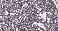 GK1/3 Polyclonal Antibody