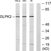 GK2 Polyclonal Antibody