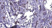 GK2 Polyclonal Antibody