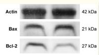 Bcl-2 Polyclonal Antibody
