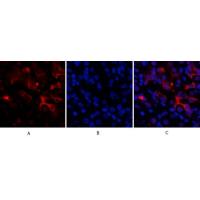 Bcl-6 Polyclonal Antibody