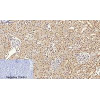 Bcl-6 Polyclonal Antibody