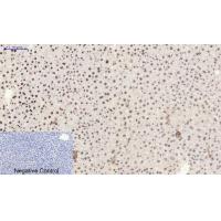 Bcl-6 Polyclonal Antibody
