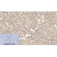 Bcl-6 Polyclonal Antibody