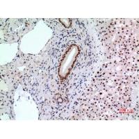 Bcl-6 Polyclonal Antibody