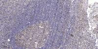 Bcl-6 Polyclonal Antibody