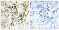 BCoR Polyclonal Antibody