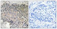 Bcr Polyclonal Antibody