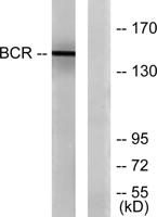 Bcr Polyclonal Antibody