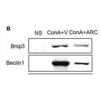 Beclin-1 Polyclonal Antibody