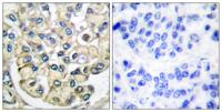 FGF Receptor 2 Polyclonal Antibody