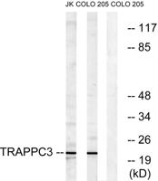 BET3 Polyclonal Antibody