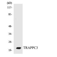 BET3 Polyclonal Antibody