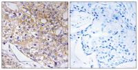 BET5 Polyclonal Antibody