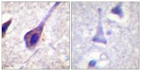 BID Polyclonal Antibody