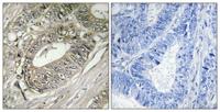 BIG2 Polyclonal Antibody