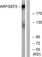 BIG2 Polyclonal Antibody
