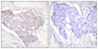 Bim Polyclonal Antibody