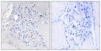 BinCARD Polyclonal Antibody