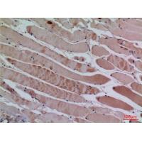 BLC Polyclonal Antibody