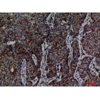 MCM3 Polyclonal Antibody