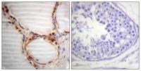 MCM4 Polyclonal Antibody