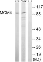 MCM4 Polyclonal Antibody