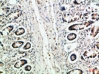 MCP-3 Polyclonal Antibody