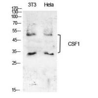 M-CSF Polyclonal Antibody