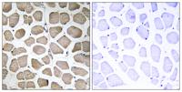 MCT12 Polyclonal Antibody
